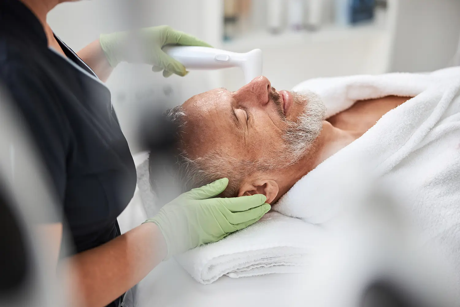 man receiving microneedling